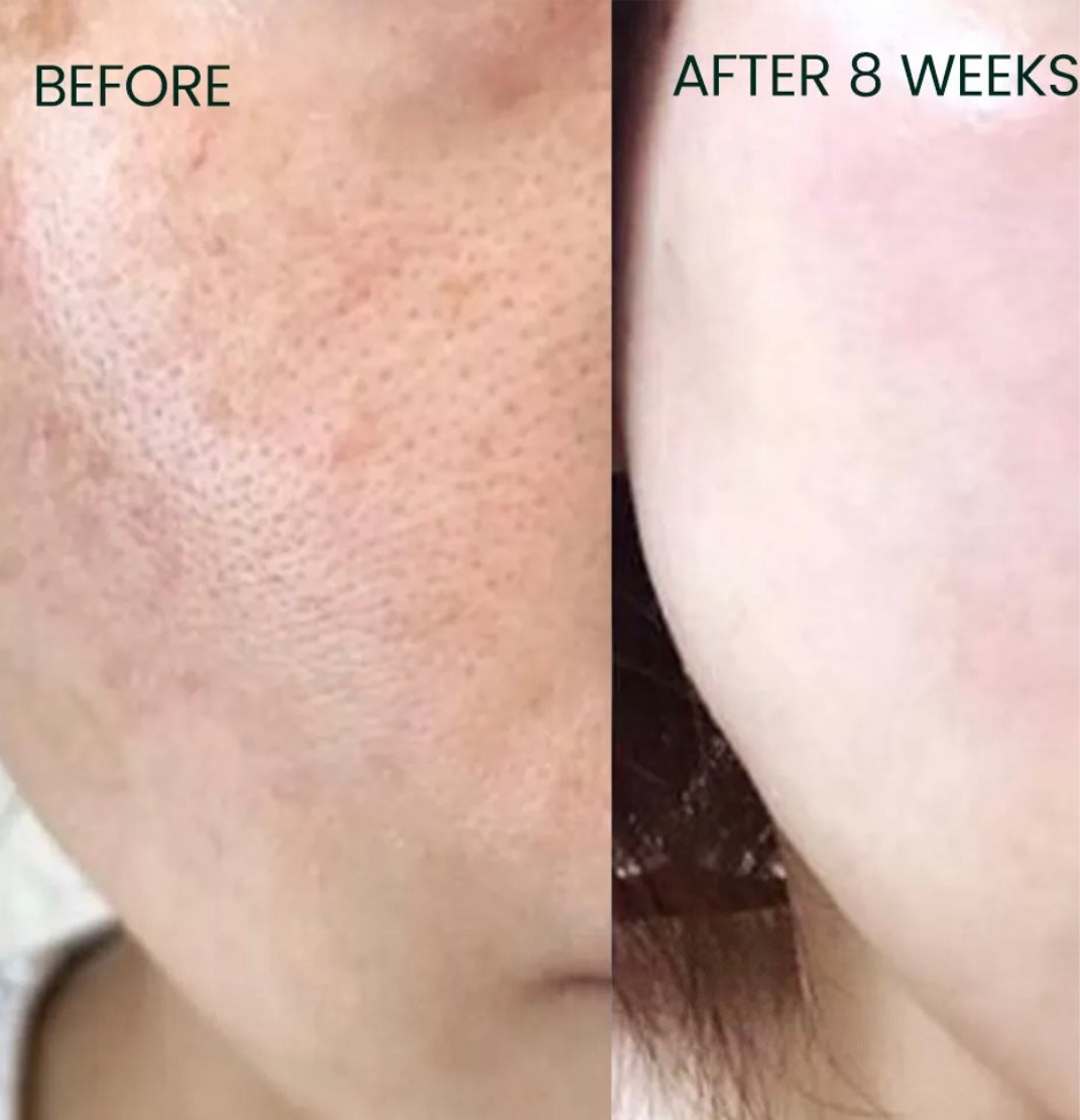 Marifer Skin Brightening Cream